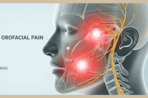 orofacial-pain